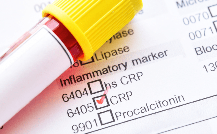  C Reactive Protein: A Comprehensive Guide